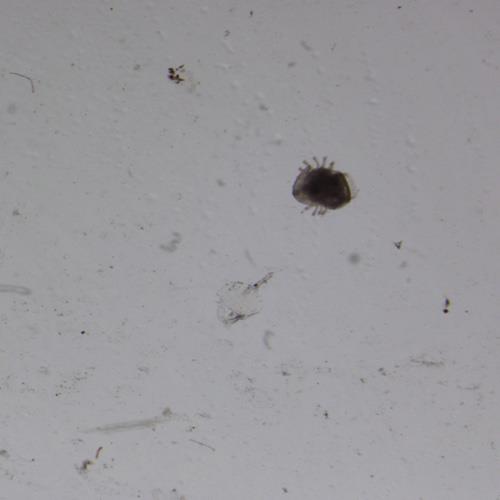 輔輪幼蟲(chóng).jpg 輔輪幼蟲(chóng).jpg