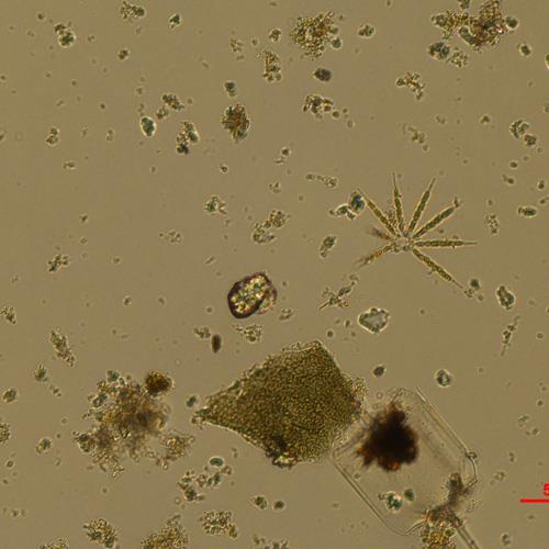 星桿藻.jpg 星桿藻.jpg