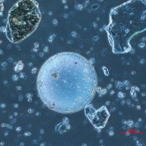 星臍圓篩藻1.jpg